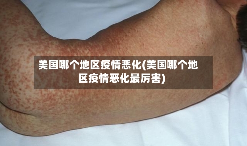 美国哪个地区疫情恶化(美国哪个地区疫情恶化最厉害)