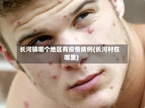 长河镇哪个地区有疫情病例(长河村在哪里)-第2张图片