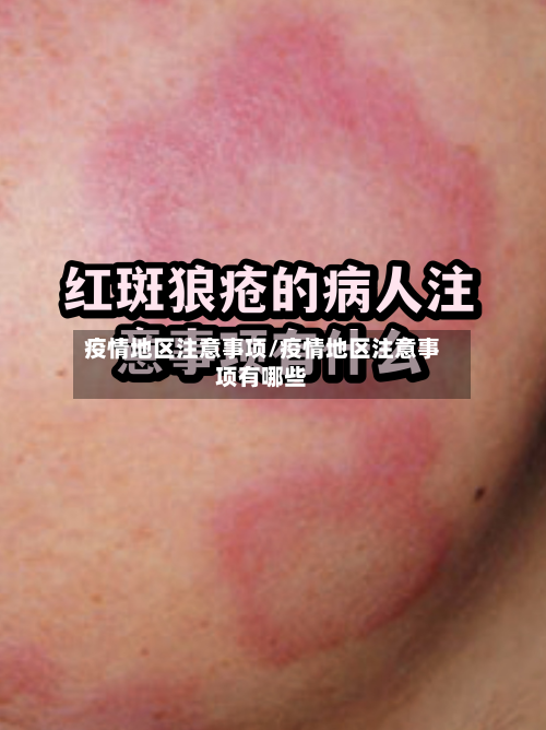 疫情地区注意事项/疫情地区注意事项有哪些-第3张图片