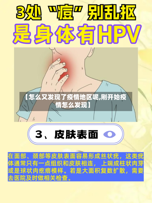 【怎么又发现了疫情地区呢,刚开始疫情怎么发现】-第3张图片